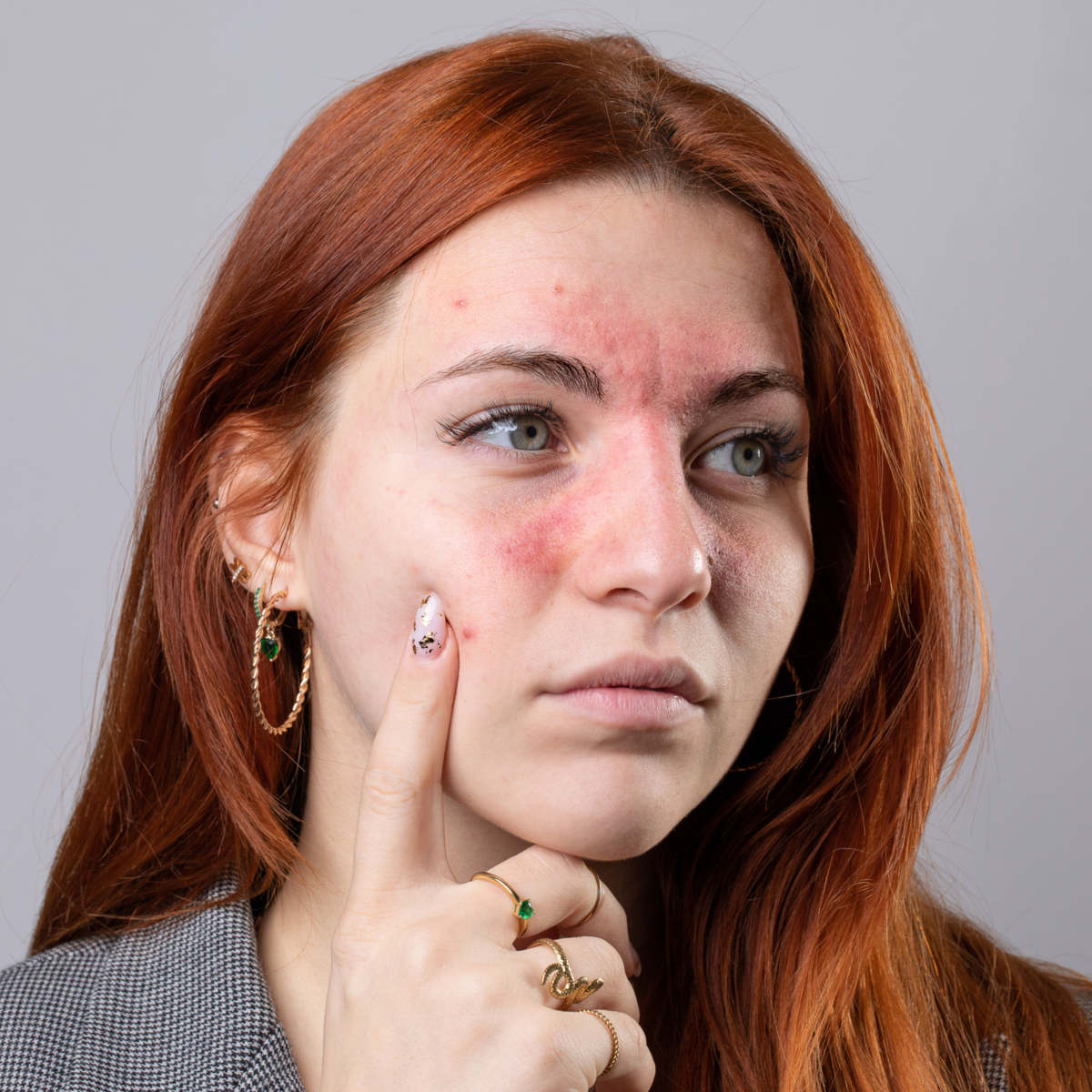 Minor Ailments Assessments and Prescriptions